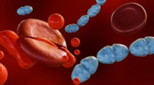 Septicemia