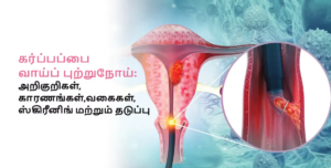 கர்ப்பப்பை வாய்ப் புற்றுநோய் தடுப்பு: இந்தியாவின் புதிய சகாப்தம்!