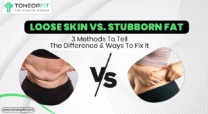 Loose skin while decreasing weight